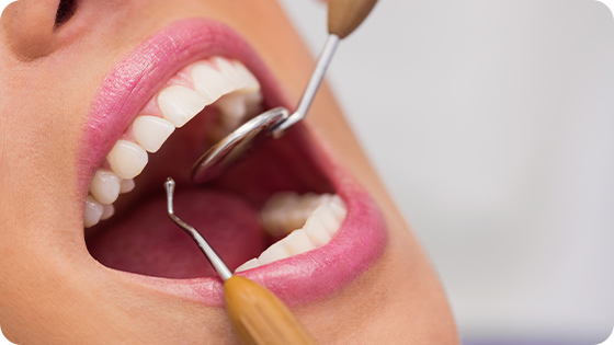 A Restauração Dental que você merece com a estrutura perfeita para seu tratamento é aqui na Vitae