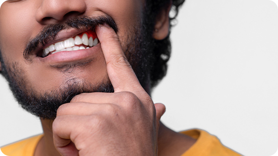 Atenção e cuidado aos tecidos que sustentam os dentes, resultando em mais saúde e higiene bucal